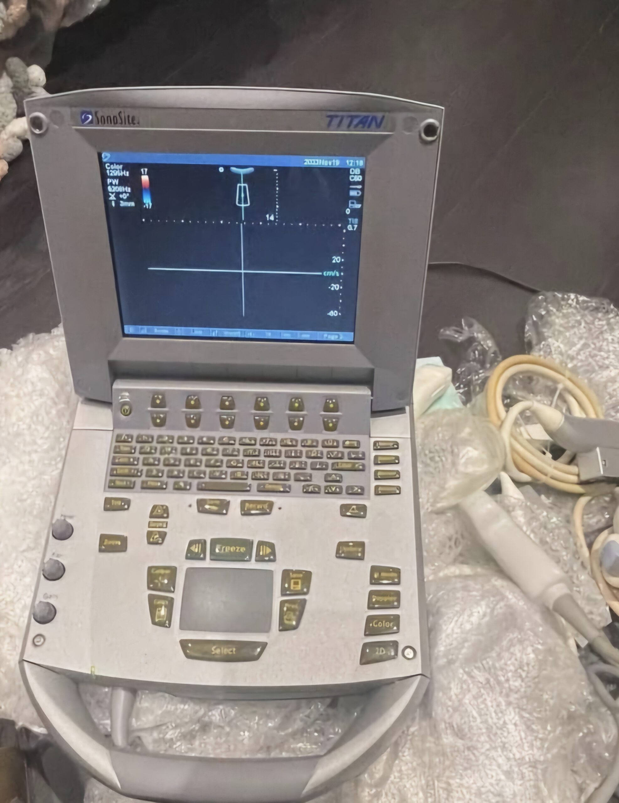 Titan SonoSite Ultrasound